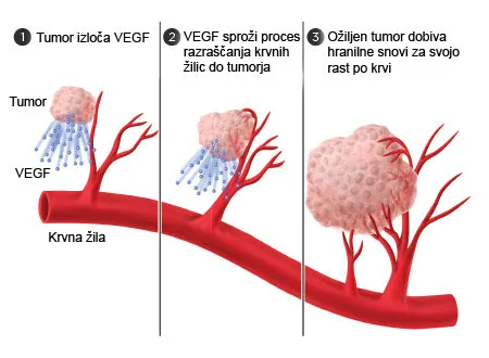Angiogeneza - VEGF sproži proces razraščanja krvnih žilic do tumorja